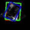A boosting regression approach to medical anatomy detection