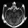 A new quality metric for image fusion