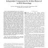 Automatic Identification of Artifact-Related Independent Components for Artifact Removal in EEG Recordings
