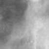 Content-based image retrieval for digital mammography