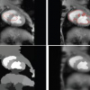 Curious Snakes: a minimum-latency solution to the cluttered background problem in active contours