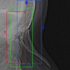 First Steps toward Automatic Location of Landmarks on X-Ray Images