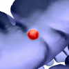 Virtual Fly-Over: A New Visualization Technique For Virtual Colonoscopy