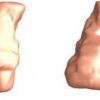 Hippocampal Surface Analysis Using Spherical Harmonic Function Applied to Surface Conformal Mapping