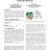 How genetic algorithms can improve a pacemaker efficiency