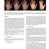 Human hand modeling from surface anatomy