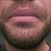 Jumping snakes and parametric model for lip segmentation