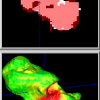 Level-Set Evolution with Region Competition: Automatic 3-D Segmentation of Brain Tumors