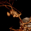 LiveSync: Deformed Viewing Spheres for Knowledge-Based Navigation