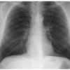 Introduction to Medical Image Modalities and Scanners