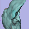 Multi-Modal Non-Rigid Registration Using a Stochastic Gradient Approximation