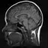 Multigrid image reconstruction from arbitrarily spaced samples