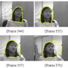 Optimal radial contour tracking by dynamic programming