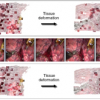 A Probabilistic Framework for Tracking Deformable Soft Tissue in Minimally Invasive Surgery
