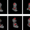 Reconciling Landmarks and Level Sets