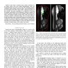 Removal of Partial Occlusion from Single Images