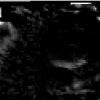 Robust statistical registration of 3D ultrasound images using texture information