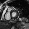 Segmentation of the evolving left ventricle by learning the dynamics