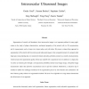 Shape-Driven Segmentation of the Arterial Wall in Intravascular Ultrasound Images