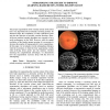 Subsampling strategies to improve learning-based retina vessel segmentation