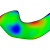 Support vector machine for data on manifolds: An application to image analysis