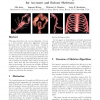 TEASAR: Tree-Structure Extraction Algorithm for Accurate and Robust Skeletons