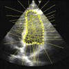 Ultrasound imaging LV tracking with adaptive window size and automatic hyper-parameter estimation