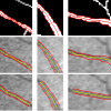 Extraction of Tubular Structures over an Orientation Domain