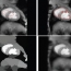 Curious Snakes: a minimum-latency solution to the cluttered background problem in active contours