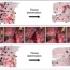 A Probabilistic Framework for Tracking Deformable Soft Tissue in Minimally Invasive Surgery